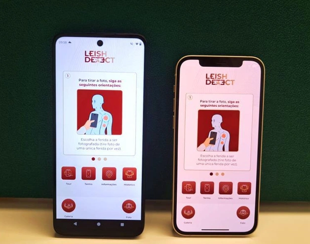 Leish Detect utiliza IA para diagnosticar la leishmaniasis cutánea mediante un teléfono inteligente, sin necesidad de conexión a internet.